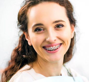 Hidden Braces Help Straighten Crooked Teeth If You Don’t Want Traditional Braces