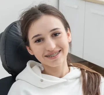 Ceramic Braces Guide: Everything You Need to Know