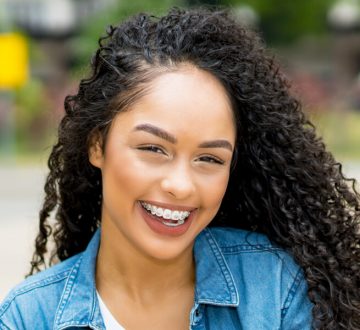 Ceramic Braces Guide: Everything You Need to Know