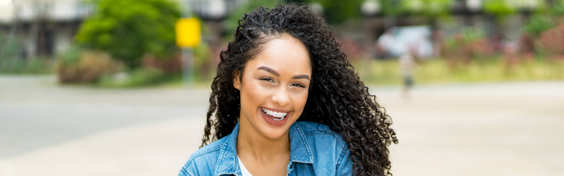 Ceramic Braces Guide: Everything You Need to Know