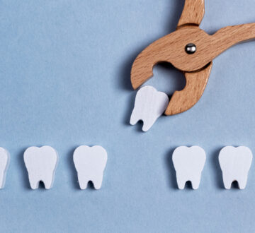 Keeping Your Mouth Healthy After Tooth Extraction