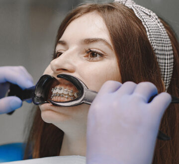 Traditional Braces for Adults and Teens: What You Need to Know