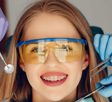Hidden Braces: The Discreet Way to Achieve a Beautiful Smile