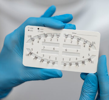 The Benefits of Orthodontics