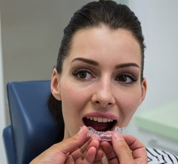 What to Expect at Your First Clear Aligner Consultation